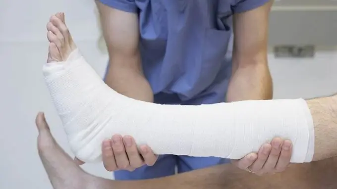 Kako omekšati gips za uklanjanje